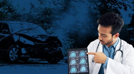 Types of Head Injuries from Car Accidents