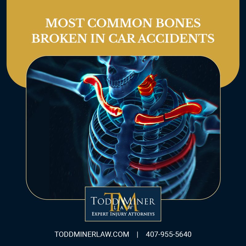 Most Common Bones Broken in Car Accidents