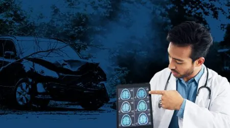 Types of Head Injuries from Car Accidents